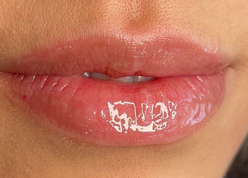 Close-up of glossy lips showcasing beauty treatment at Studio Ap & Co, Neutral Bay, New South Wales, AU.