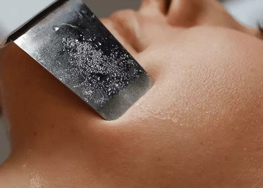 Tratamiento de exfoliación facial en Advanced Aesthetics VM, Villamartín, Comunidad Valenciana, ES.