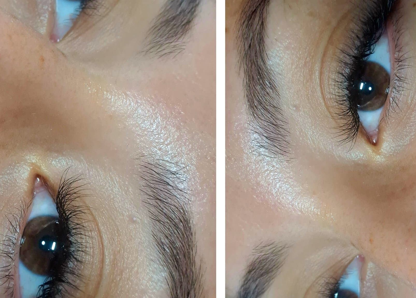 Cerca de los ojos después del tratamiento en Advanced Aesthetics VM, Villamartín, Comunidad Valenciana, ES.