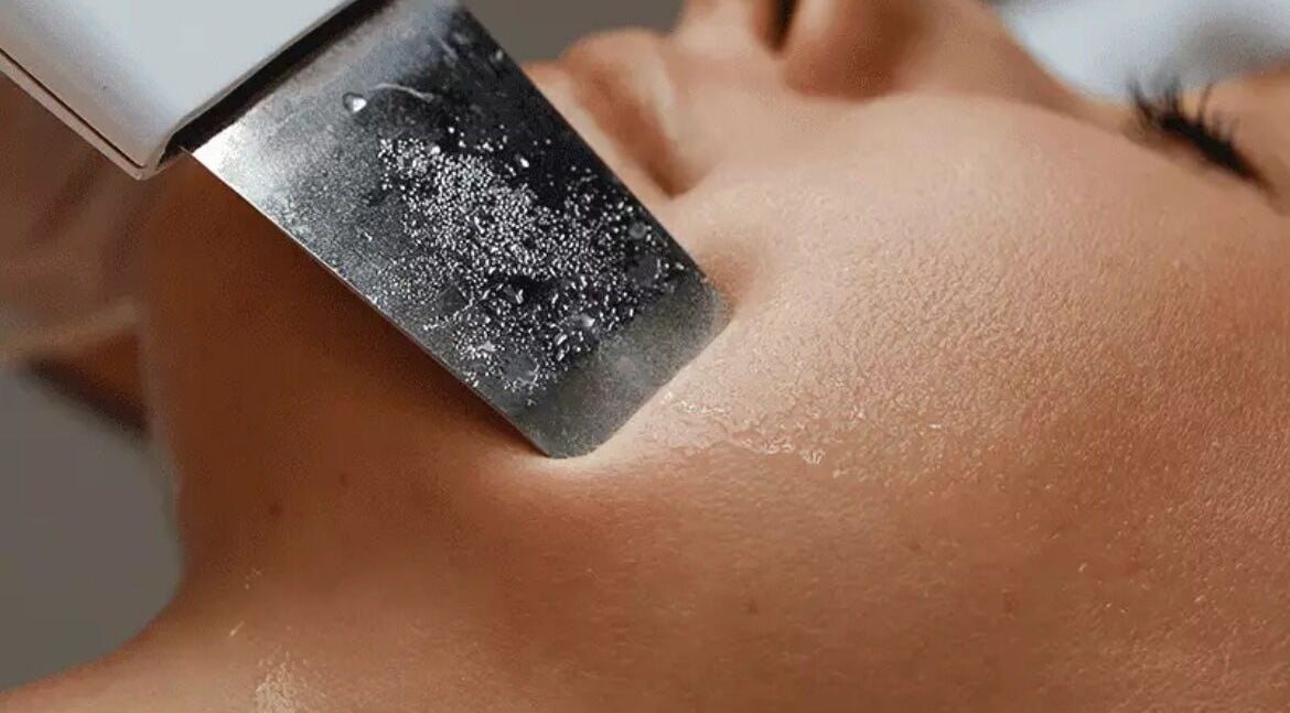 Tratamiento de peeling ultrasónico en Advanced Aesthetics VM, Villamartín, Comunidad Valenciana, ES.