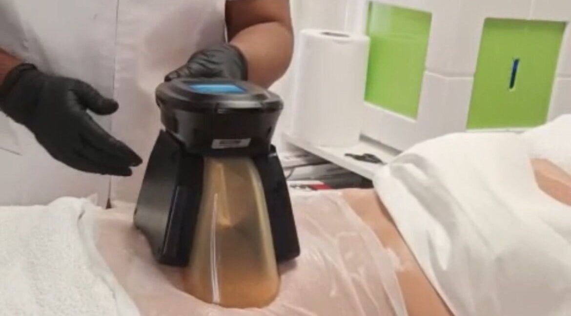 Tratamiento estético en Advanced Aesthetics VM, Villamartín, Comunidad Valenciana, ES.