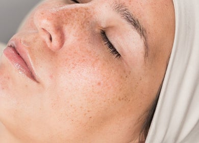 Tratamiento facial en Vela Clinic, Barcelona, Cataluña, ES, destacando piel fresca y relajada.