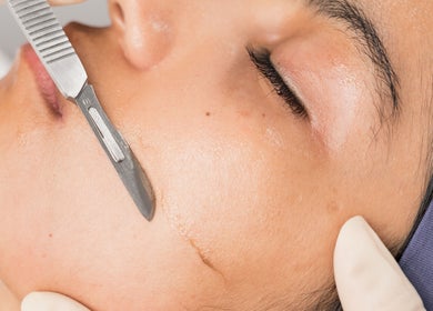 Tratamiento facial dérmapeeling en Vela Clinic, Barcelona, Cataluña, ES, realzando la piel suave y luminosa.