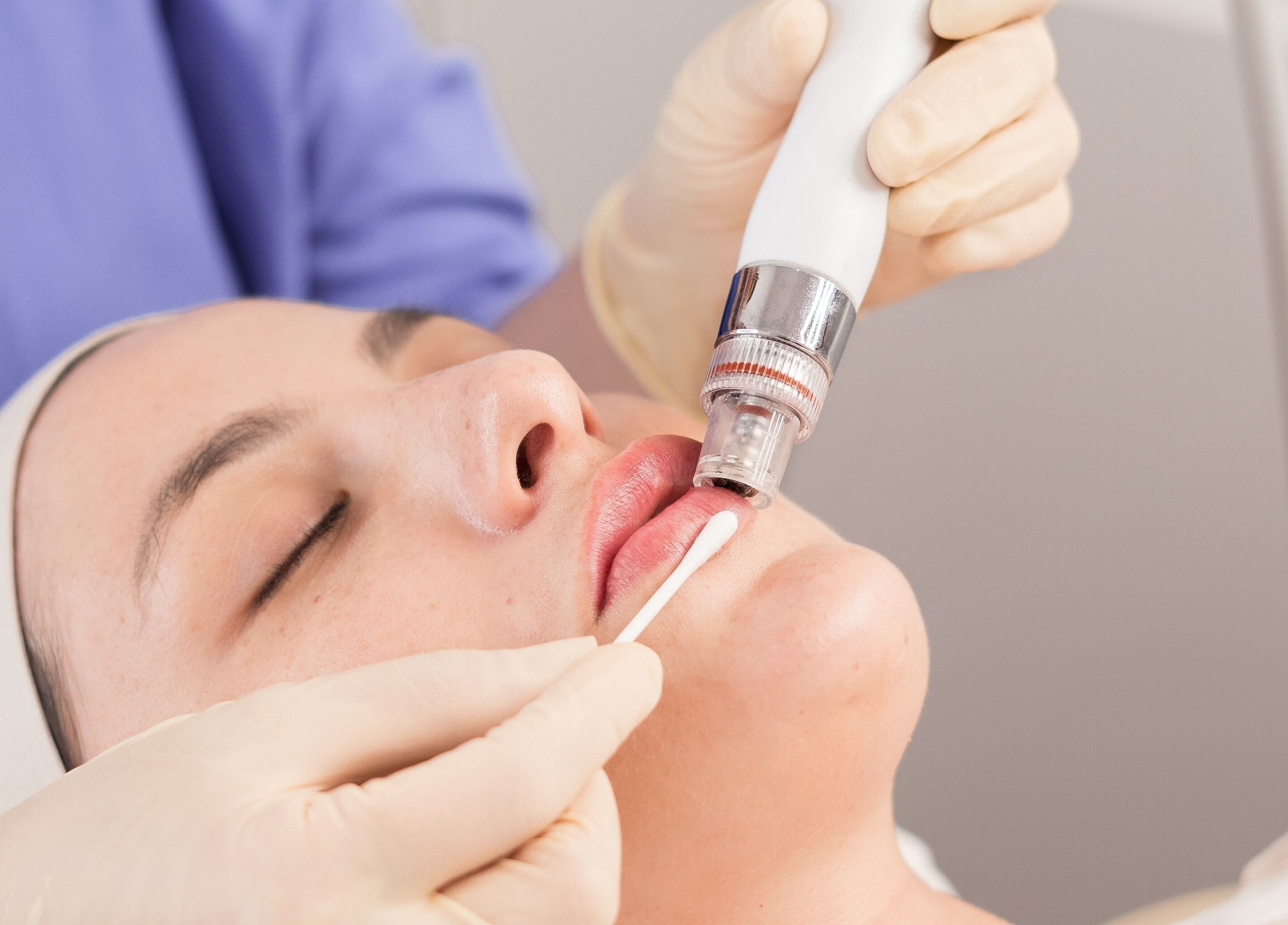 Tratamiento facial en Vela Clinic, Barcelona, Cataluña, ES, realzando la belleza natural con tecnología avanzada.