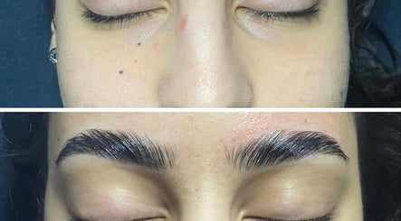 Before and after eyebrow shaping at Glow & Grace Esthetics, Calgary, Alberta, CA shows dramatic results.