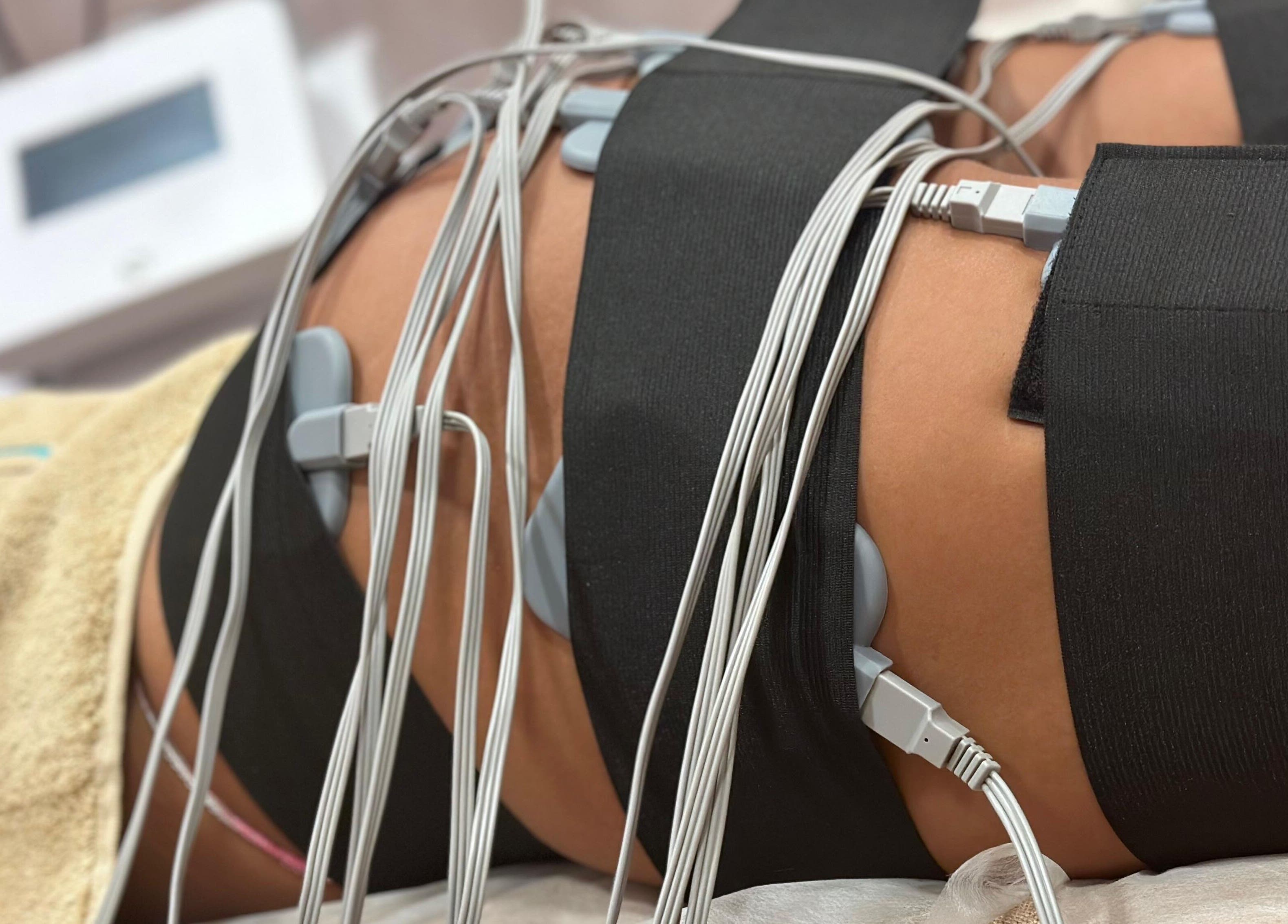 Procedimento EmSculpt na Bodyglow em Leça Da Palmeira, Porto, PT, mostrando equipamentos avançados.