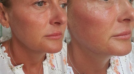 Skin and Sculpt by Victoria Cottle