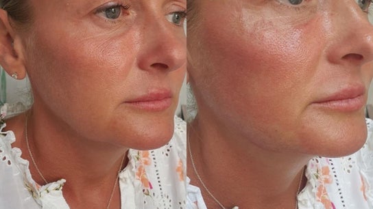 Skin and Sculpt by Victoria Cottle