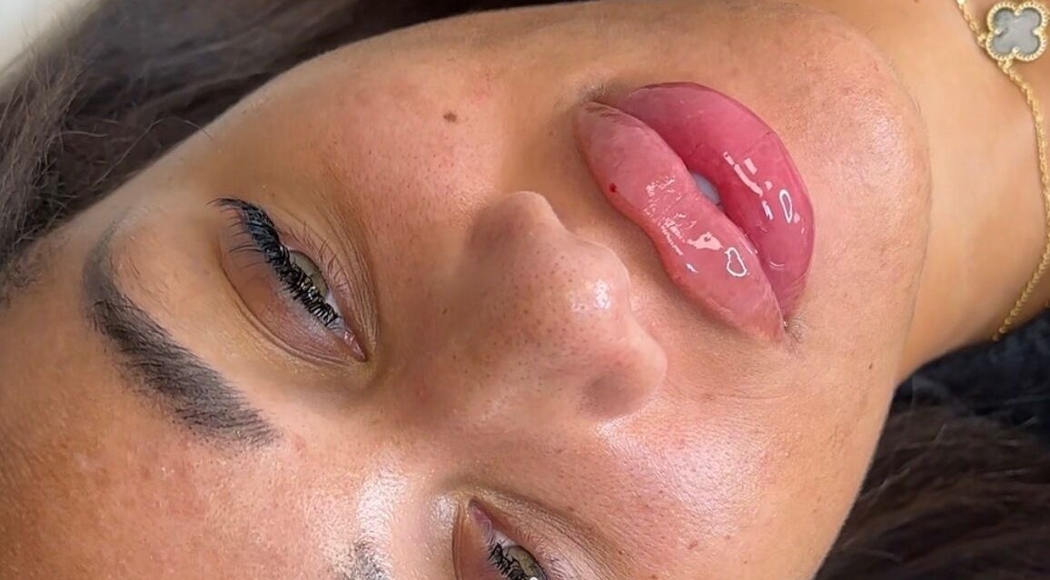 Close-up of glossy lips enhancement at By Charlie Jade, Sheffield, England, GB.
