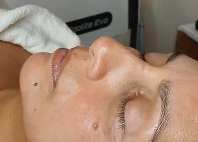 Tratamiento facial en Amaia Estética Profesional en Mendoza, Mendoza, AR, destacando el cuidado y relajación.
