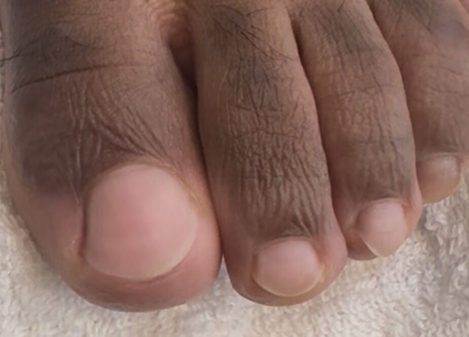 Freshly groomed toenails at The Nail Groomer Hands & Foot Care, Duluth, Georgia, US.