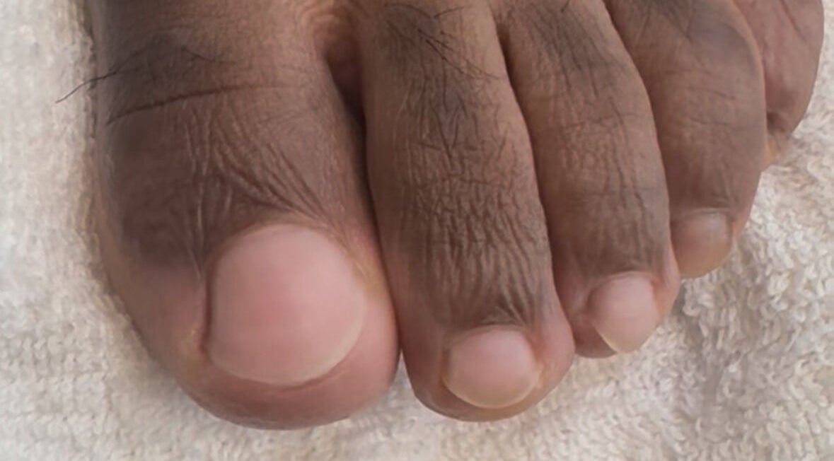 Freshly groomed toenails at The Nail Groomer Hands & Foot Care, Duluth, Georgia, US.