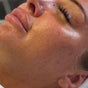 SKIN. Eleven