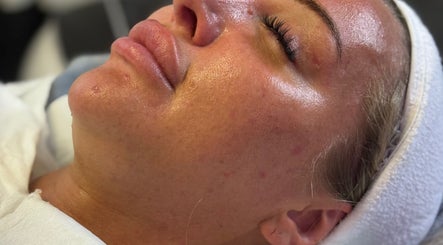 SKIN. Eleven