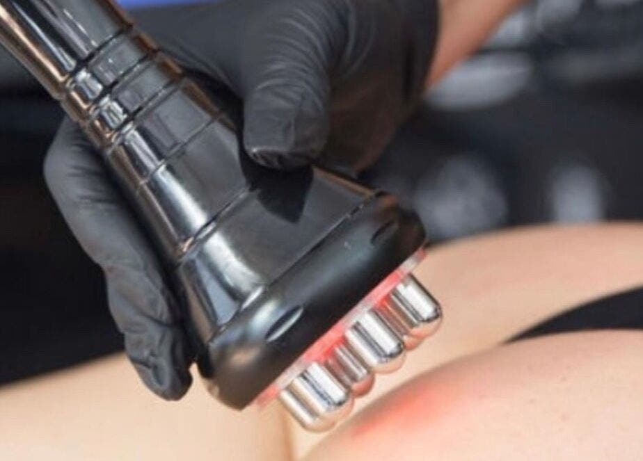 Body contouring treatment at Define & Sculpt in Folkestone, England, GB. Advanced device for skin enhancement.