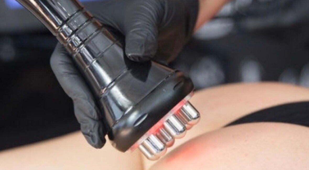 Body contouring treatment at Define & Sculpt in Folkestone, England, GB. Advanced device for skin enhancement.