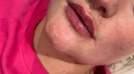 FacesbySLS image 3