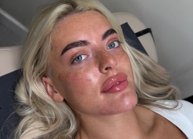 Client with glowing skin after a beauty treatment at themaedclub, Swallownest, England, GB.