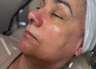Facial treatment at themaedclub in Swallownest, England, GB highlighting a peaceful, refreshed complexion.