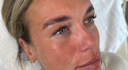 Immagine 2, Skinny Lash