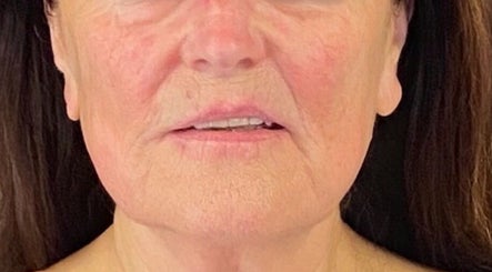 The Skin Place image 3