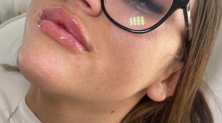 Bellesaesthetics slika 3