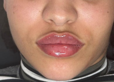 Close-up of glossy lips after treatment at Milèro Aesthetics, Sheffield, England, GB.