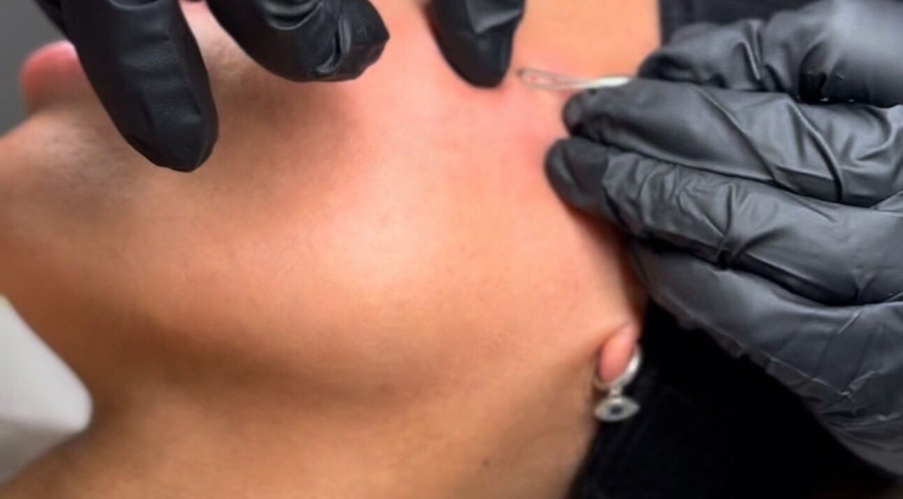 Facial treatment at SADE Aesthetics Berkshire, Reading, England, GB. Black-gloved hands performing skincare.