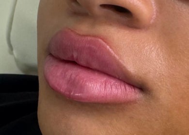 Close-up of glossy lips from SADE Aesthetics London, showcasing beauty in London, England, GB.