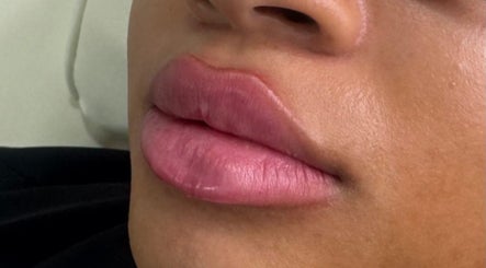 Close-up of glossy lips from SADE Aesthetics London, showcasing beauty in London, England, GB.