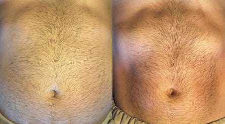 Before and after body treatment at Aura beauty @ 68 Nail & Spa, London, England, GB.