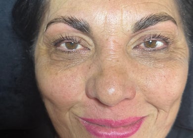 Close-up of a woman's radiant complexion after treatment at Aura Beauty - Oval, London, England, GB.