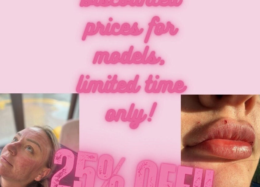 Grace’s Aesthetics in Holyhead, Wales, GB offers 25% discount for models, limited time. Facial and lip close-ups.