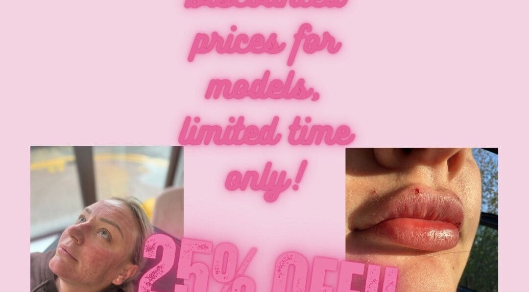 Grace’s Aesthetics in Holyhead, Wales, GB offers 25% discount for models, limited time. Facial and lip close-ups.