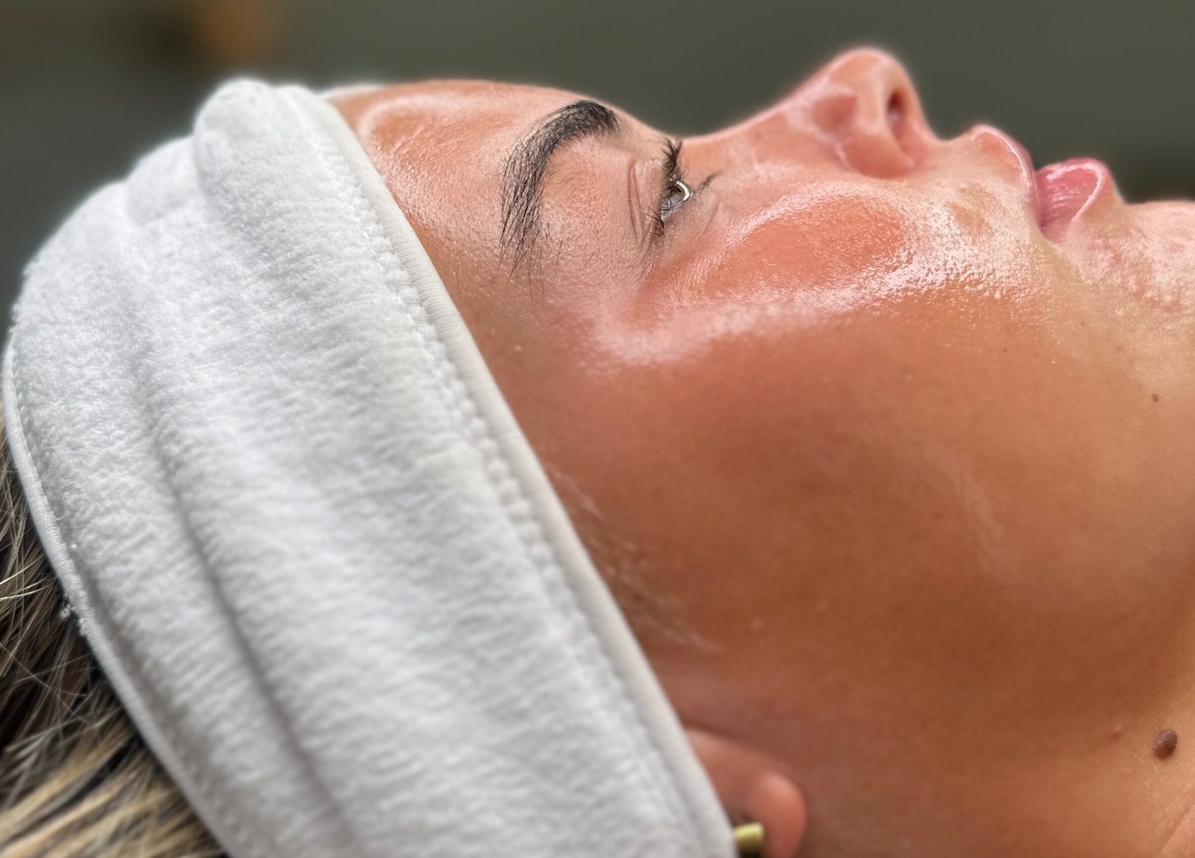 Facial treatment at Skin Clinic By Chloé in Comberton, England, showcasing a glowing complexion with a headband.