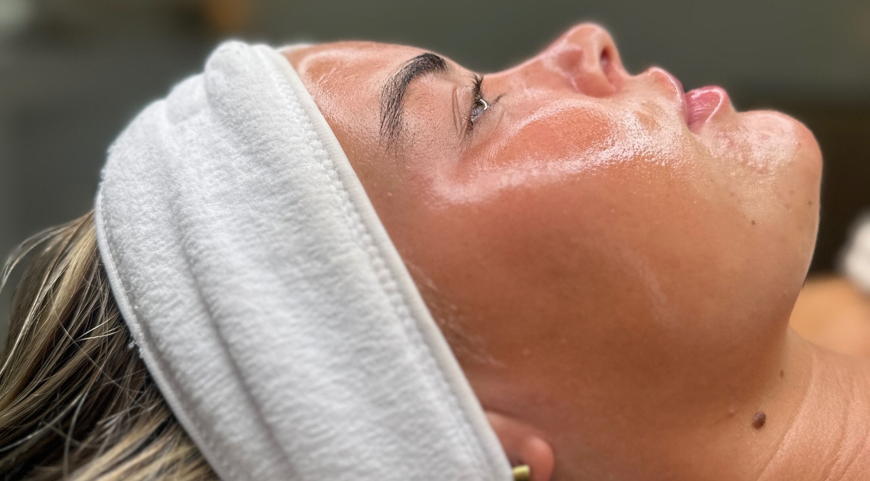 Facial treatment at Skin Clinic By Chloé in Comberton, England, showcasing a glowing complexion with a headband.
