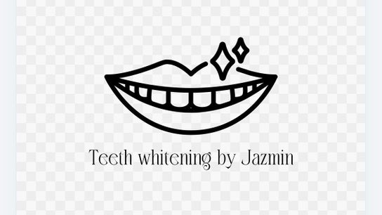 Teeth Whitening by Jazmin