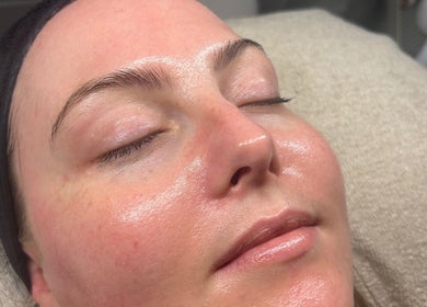 Relaxed face post-treatment at Skin Space by Lauren, Worsley, England, GB.