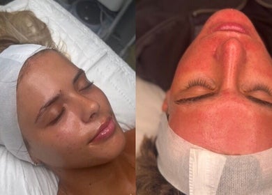 Relaxed clients with glowing skin post-facial at SkinCure, Featherstone, England, GB.