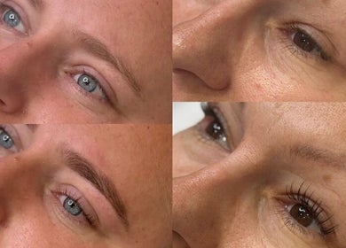 Close-up of skin rejuvenation results at SkinCure in Featherstone, England, GB.