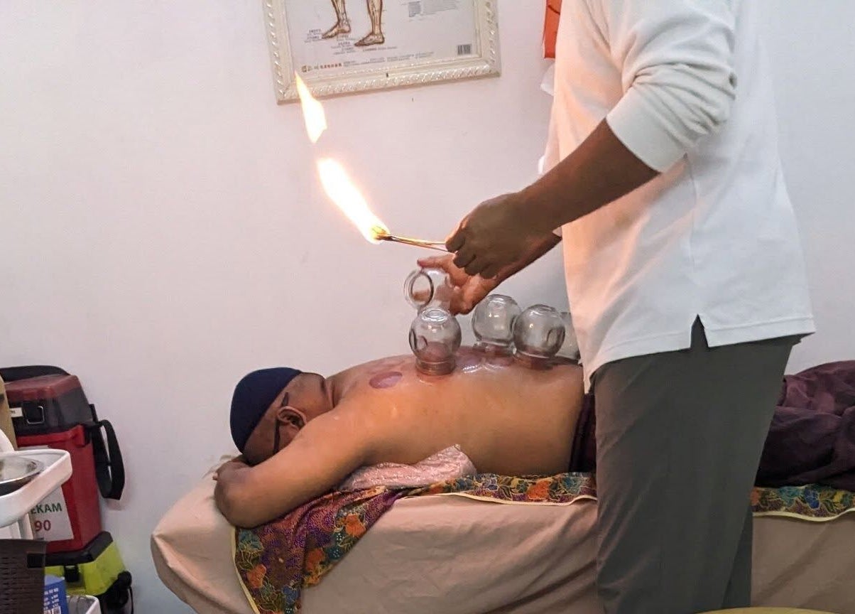 Cupping therapy session at Al Raed Wellness Centre, Batu Caves, Wilayah Persekutuan Kuala Lumpur, MY.