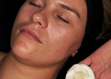 Facial treatment at Naked Beauty, North Weald Bassett, GB showcasing glowing, rejuvenated skin.