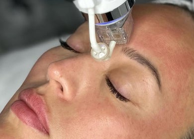Tratamiento facial avanzado en Malena Estética Barcelona, ubicada en Barcelona, Catalunya, ES.
