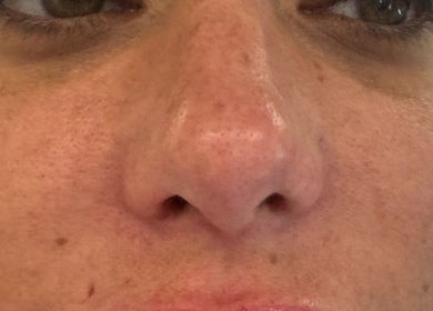 Close-up view of smooth skin treatment at Gorgeous Gate Aesthetics, Burgess Hill, England, GB.