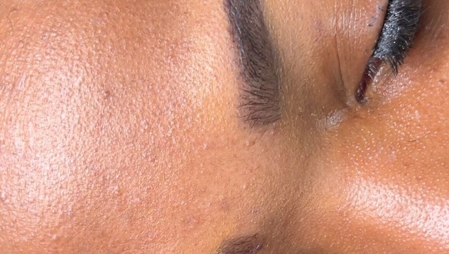Close-up of smooth, radiant skin after facial treatment at Glamour & Grace, Bedford, Ohio, US.