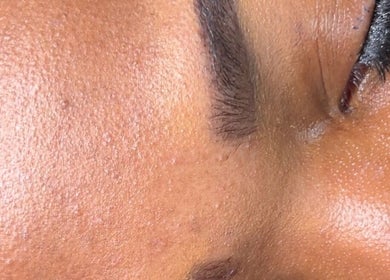 Close-up of smooth, radiant skin after facial treatment at Glamour & Grace, Bedford, Ohio, US.