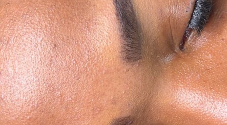 Close-up of smooth, radiant skin after facial treatment at Glamour & Grace, Bedford, Ohio, US.