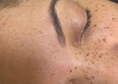 Close-up of glowing skin after treatment at Glamour & Grace, Bedford, Ohio, US.