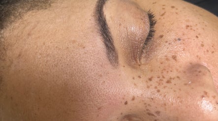 Close-up of glowing skin after treatment at Glamour & Grace, Bedford, Ohio, US.