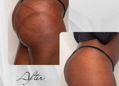 Body contour resultaat bij House Of Bliss, Zeist, Utrecht, NL. Geniet van gladde en strakke vormen.